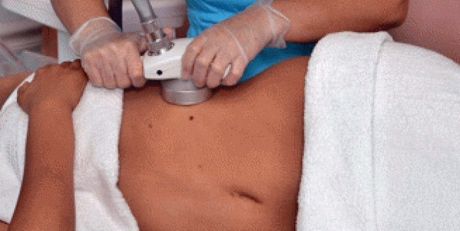 59€ από 1490€ (-96%) για ένα Πακέτο Αδυνατίσματος και Σύσφιξης που περιλαμβάνει 5 Συνεδρίες Presso, 5 Συνεδρίες Thermo, 6 Συνεδρίες  Toneup, 2 Συνεδρίες Cavitation, 2 Συνεδρίες Ραδιοσυχνοτήτων RF και 2 Συνεδρίες Vacuum, στο ινστιτούτο ομορφιάς Glamour Med Spa στο Αιγάλεω.